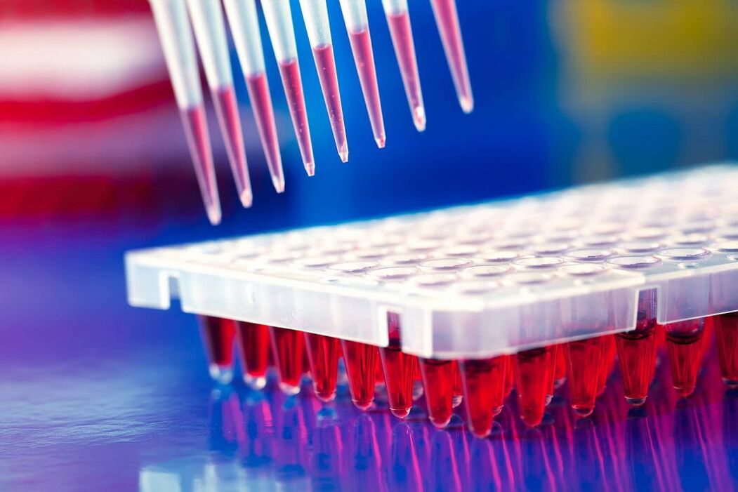 Immunoassay-Bluttest auf Parasiten