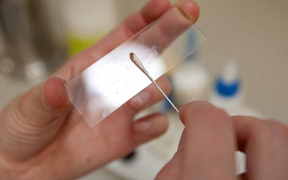 Kratzen aufgrund des Vorhandenseins von Parasiten im Körper