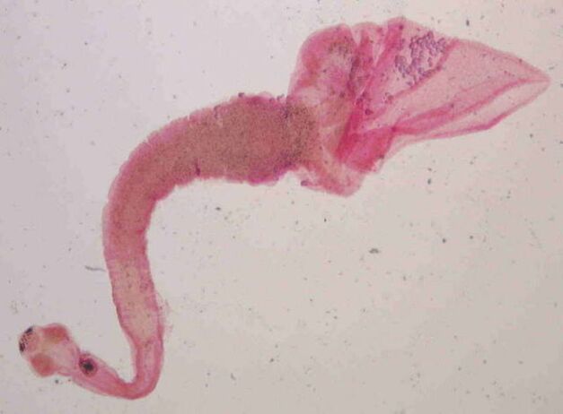 menschlicher Schweinebandwurm