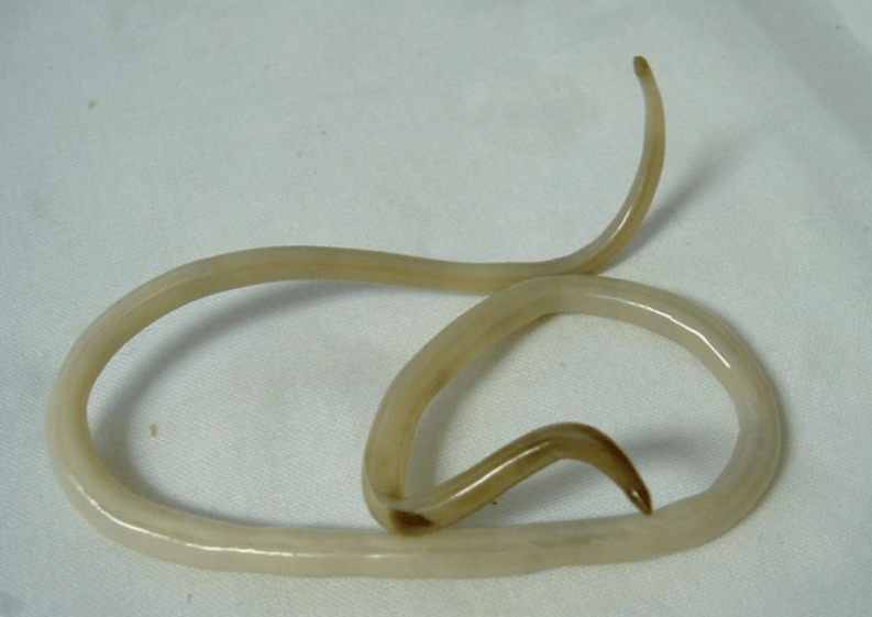 Wurm im menschlichen Körper und seine Behandlung