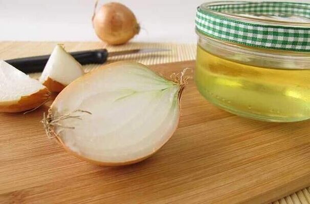 Zwiebelaufguss zur Beseitigung von Würmern, eine Woche lang angewendet.