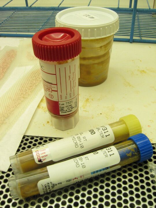 Tests zum Nachweis von Parasiten
